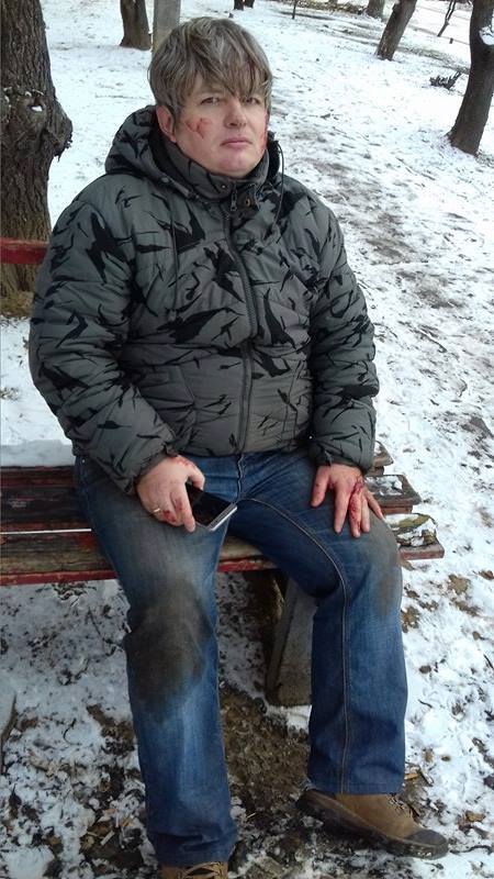 У Харкові побили музиканта-активіста Євромайдану (ФОТО) - фото 2