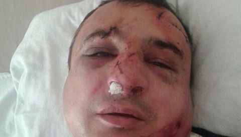 У Сіверськодонецьку жорстоко побили луганського сепаратиста Клінчаєва - фото 1