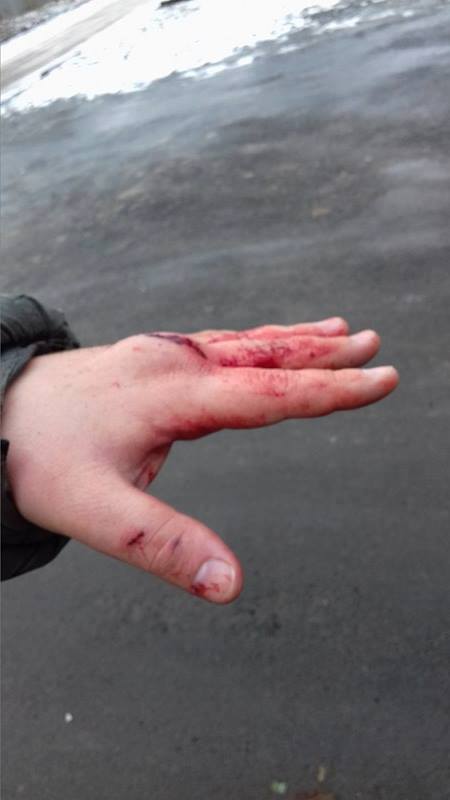 У Харкові побили музиканта-активіста Євромайдану (ФОТО) - фото 1