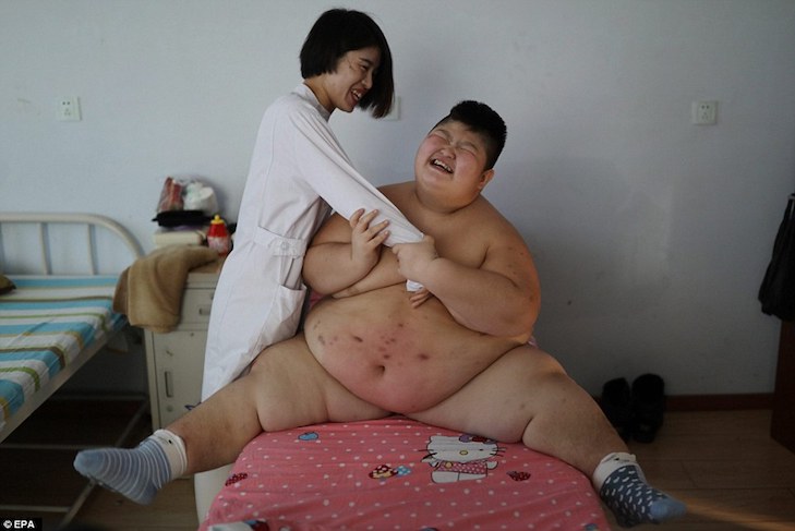 У Китаї дитину, яка важить 150 кілограмів, лікують вогнем - фото 1
