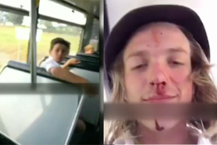 В Австралії закривавлений школяр зробив селфі відразу після аварії - фото 1