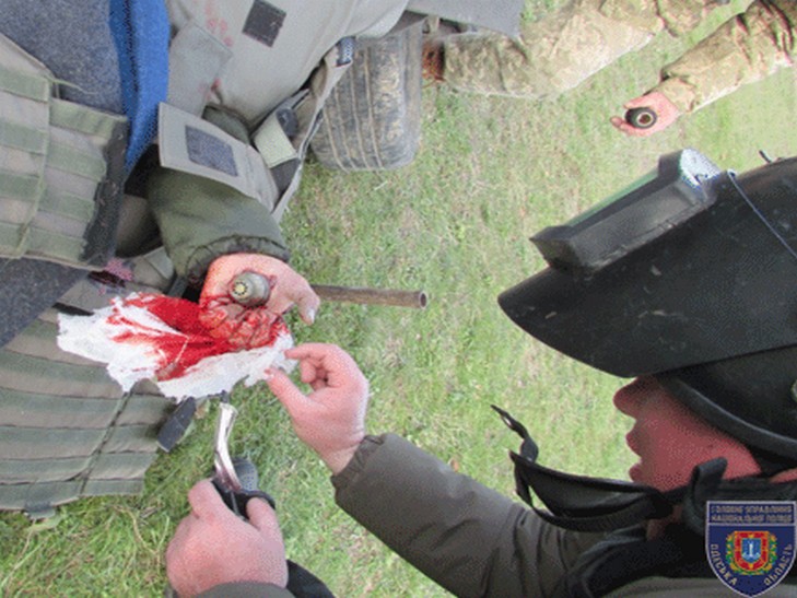 В Одесі поліцейські вибухотехніки врятували життя військовослужбовцю (ФОТО 18+) - фото 1