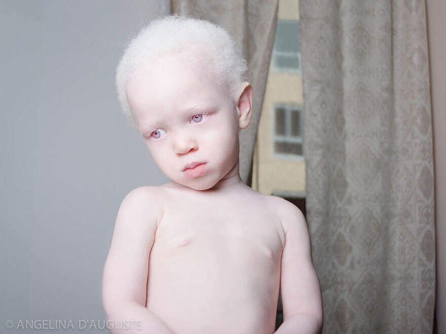 Неймовірна краса 35 людей-альбіносів - фото 9