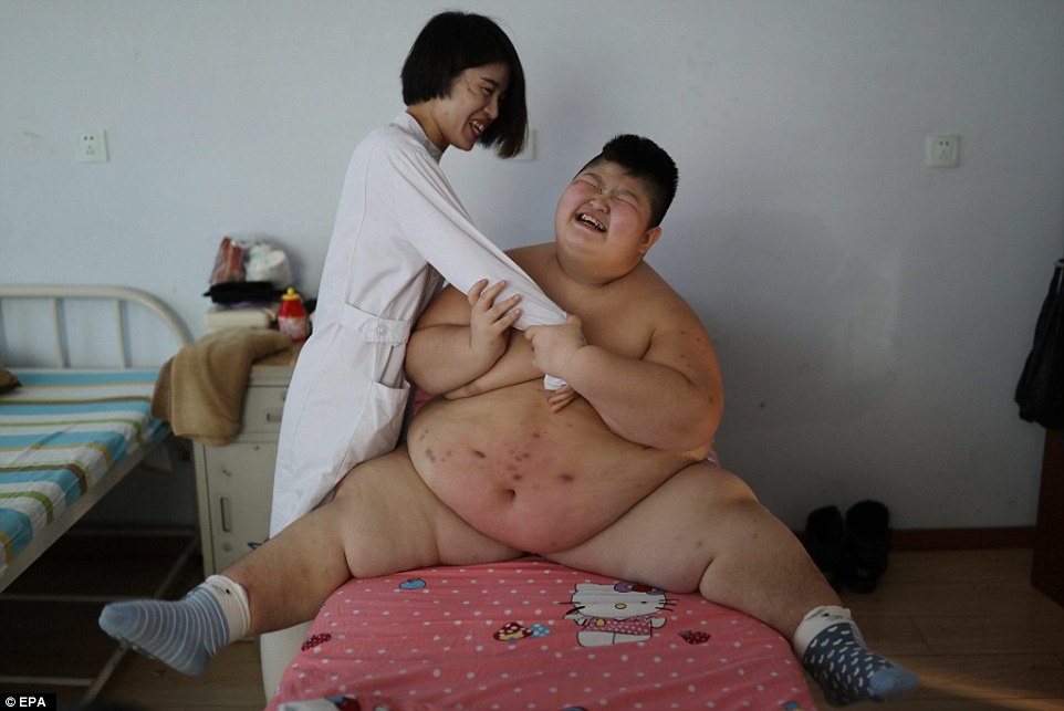 У Китаї підпалили 11-річного хлопчика, який важить 145 кг - фото 3