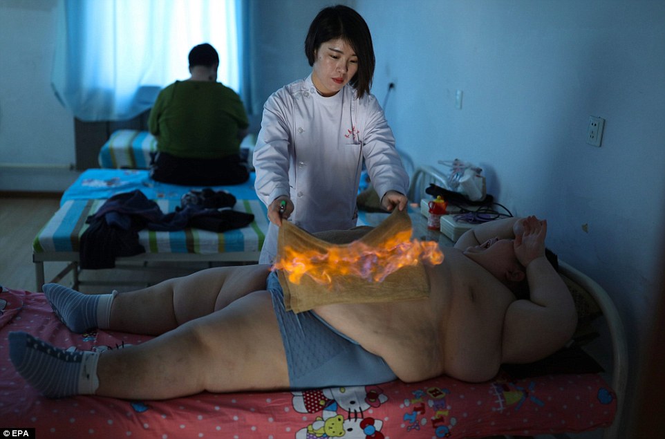 У Китаї підпалили 11-річного хлопчика, який важить 145 кг - фото 2