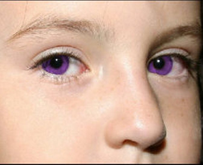 Як виглядають очі з найрідкіснішим у світі кольором - фото 1