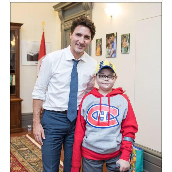 Прем'єр Канади зустрівся з хлопчиком, якого покалічило на війні у Донбасі (ФОТО) - фото 1