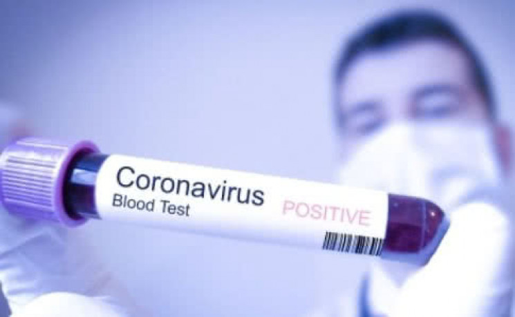 Про коронавірус розповідатимуть у навчал…