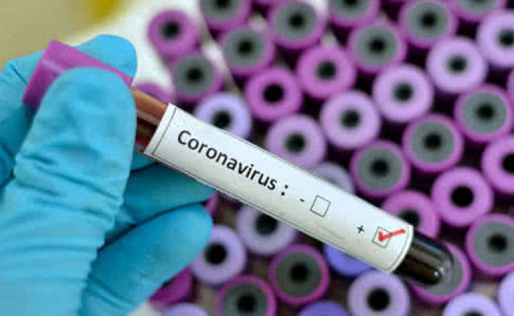 В Одессе обнаружили коронавирус у женщин…