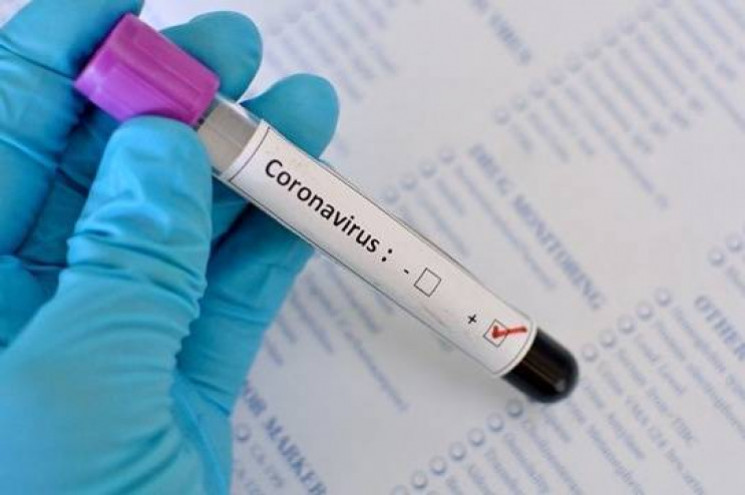 Хворий на коронавірус житель Вінниччини…