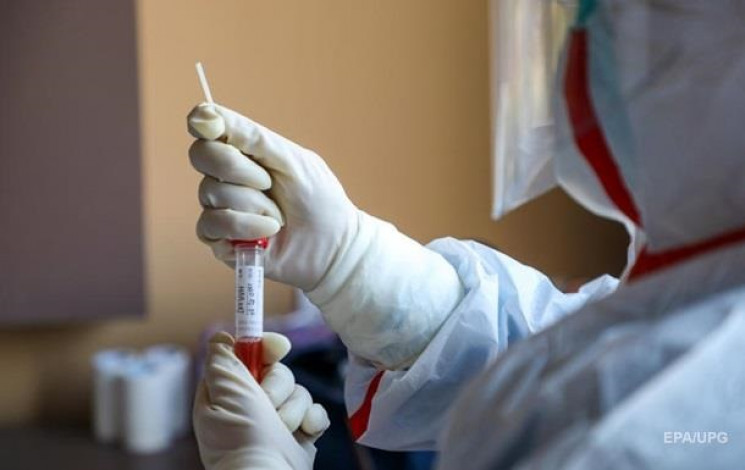 В Україні коронавірус виявили у 57 дітей…