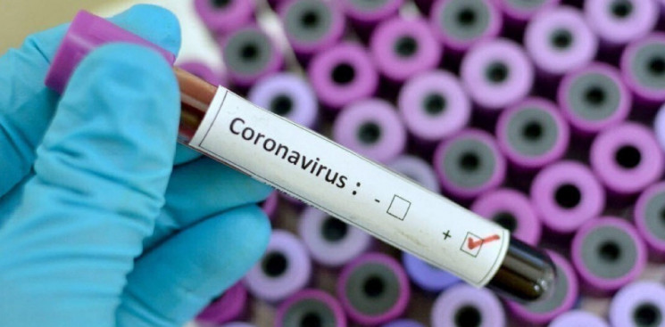 На Дніпропетровщині на коронавірус почал…