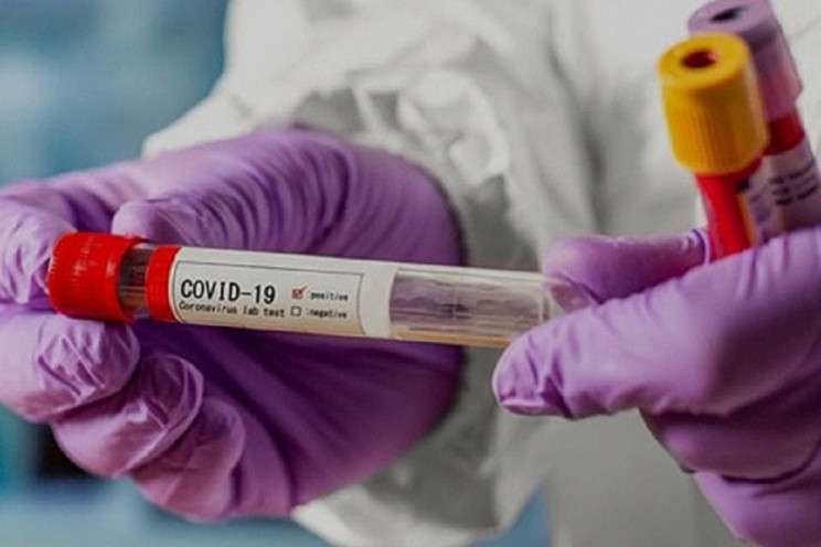 Сімнадцять нових випадків COVID-19 підтв…