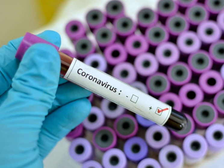 В Харківській області коронавірус поклав…