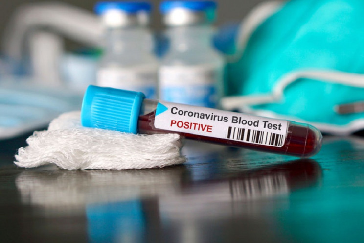 Скільки нових випадків коронавірусу підт…