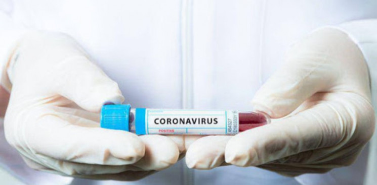 На Дніпропетровщині від коронавірусу вил…