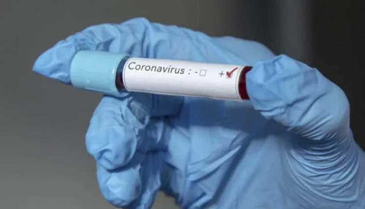 У 277 франківців підтвердили коронавірус…