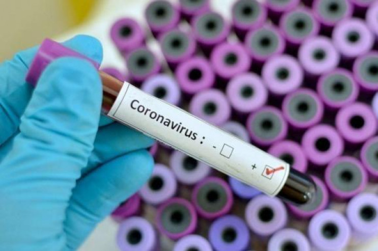 На Луганщине обнаружили четырех инфициро…