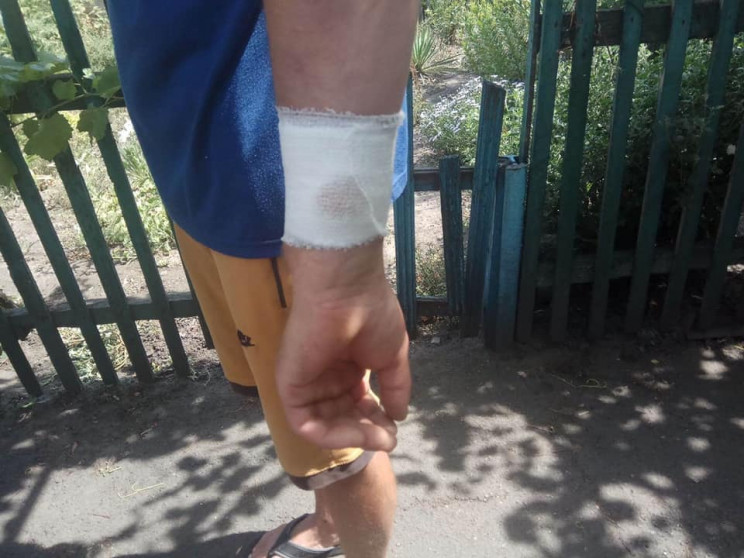 Раненый боевиками житель Марьинки расска…