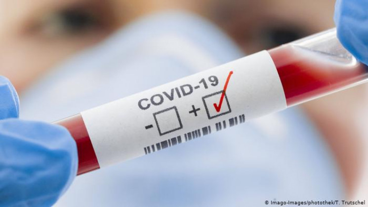 На COVID-19 захворіли 262 прикарпатців,…