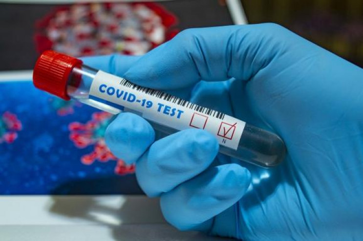 Майже 200 киян інфікувались коронавірусо…