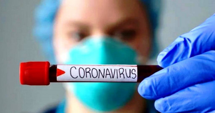 В Севастополі за добу коронавірус підтве…