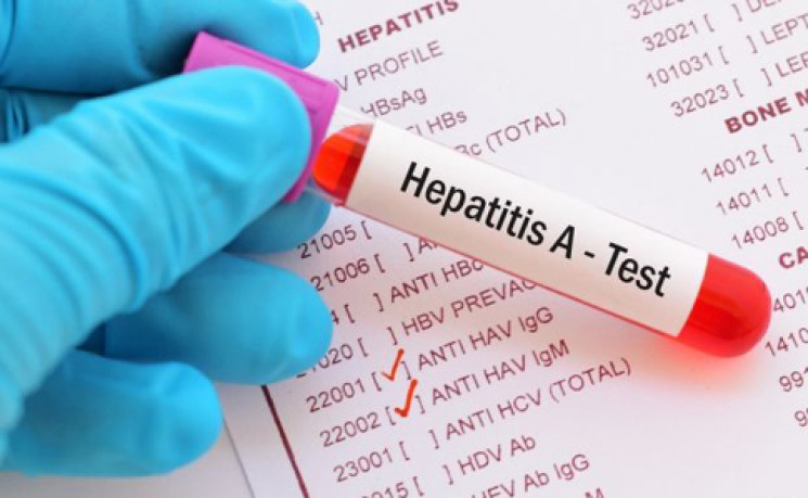 Вспышка гепатита в Раздельной: Специалис…
