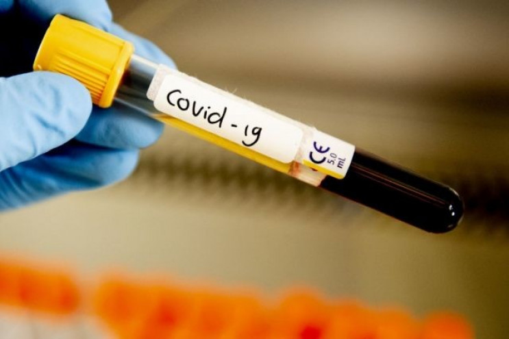 Кількість нових хворих на коронавірус в…