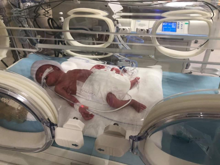 У Туреччині рятують українське немовля,…