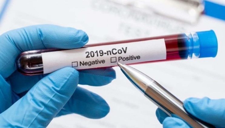 У Мукачеві 23 нових випадки коронавірусу…