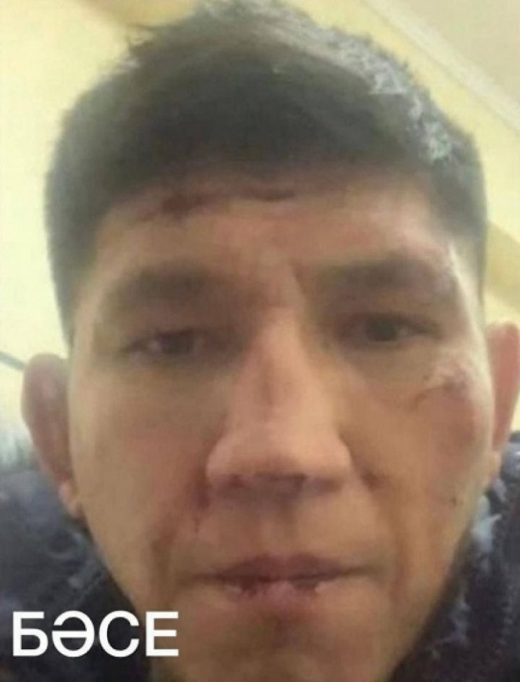 Спортсмен, избитый ОМОН в Казахстане, ре…