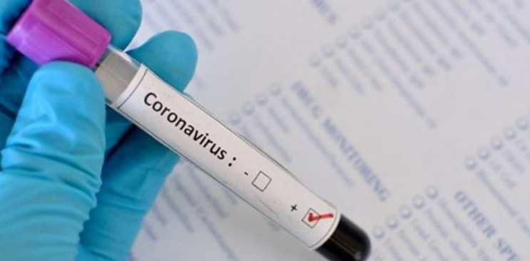 На Днепропетровщине за сутки коронавирус…