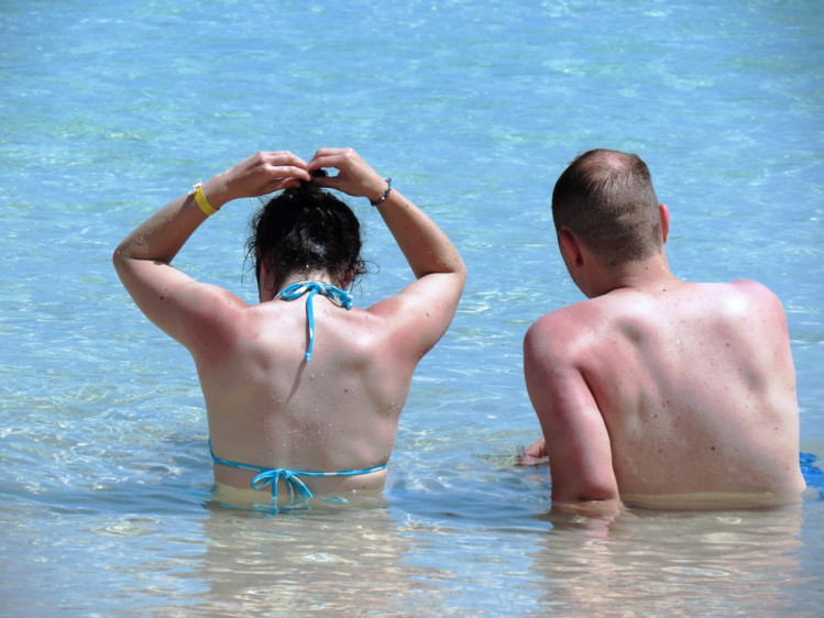 Чоловік і жінка з обгорілою шкірою у воді