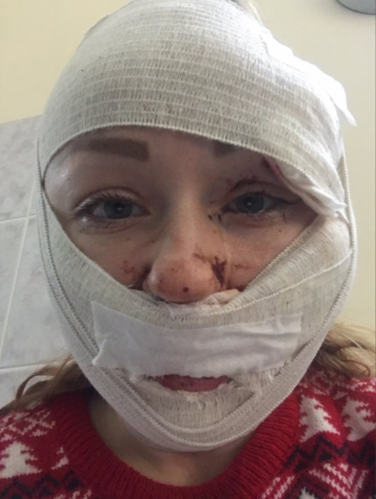 чоловік порізав обличчя українці у Туреччині 3