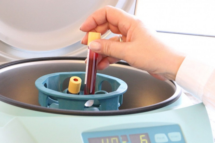 аналіз крові підготовка