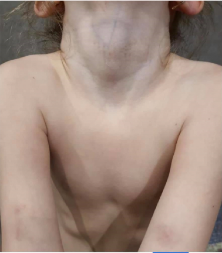 Синяки на тілі дитини після відвідування стоматолога у Рівному