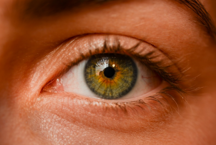 Зелено Желтые Глаза Фото