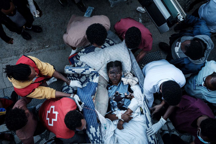 Раненый житель Тогоги прибывает в больницу в Мекеле